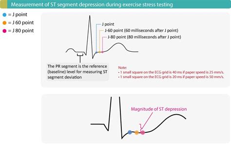 blood pressure drop stress test|stress test results positive or negative.